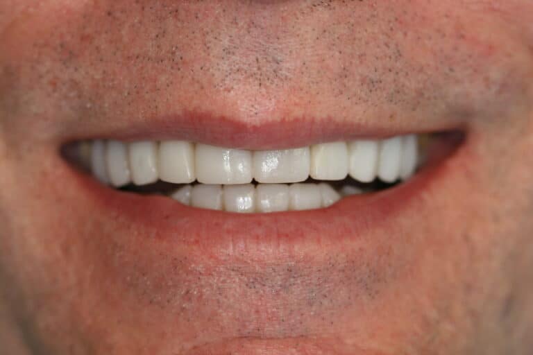 Konig Center for Cosmetic & Comprehensive Dentistry smile photos